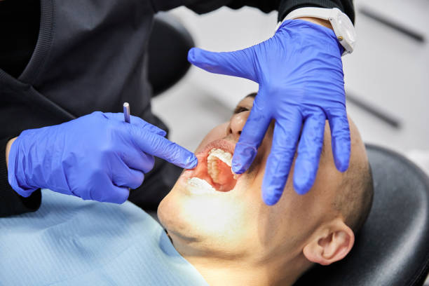 Best Cracked Tooth Emergency Dentist  in Embreeville, TN